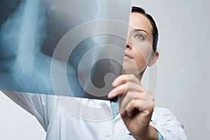 Female doctor examining x-ray image