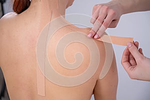 Female doctor glues kinesio tapes on the patient& x27;s shoulder.
