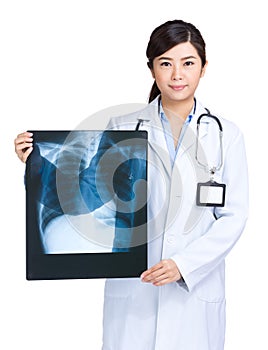 Female doctor hold chest X-ray