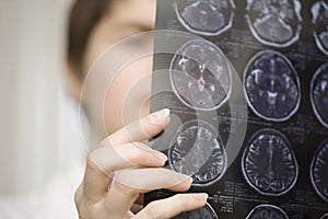 Female Doctor Holding CAT Scan