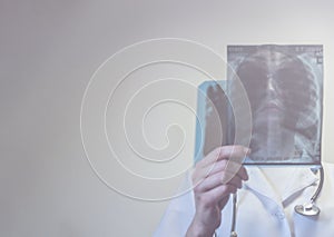 Female doctor holding X-ray of lungs, fluorography, roentgen in hospital. Woman in medical gown, stethoscope in consulting room.