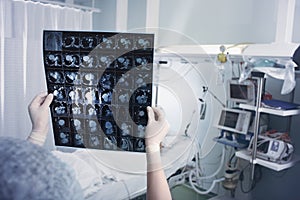 Female doctor looking at the MRI scan against the patient lying in the bed in the intensive care unit