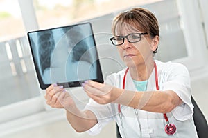 Female doctor looking at x-ray
