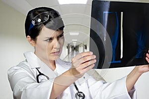 Female doctor looking at an x-ray in a hospital