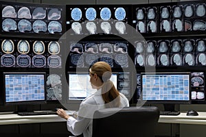 Female doctor looking at x-ray images of brain and spinal cord, A neuroscientist researching the human brain in multiple monitor,