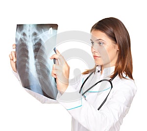 Female doctor looking at x-ray picture of lungs