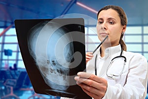 Female doctor in office looking at Xray results