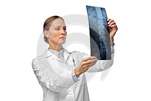 female doctor with x-ray of spine
