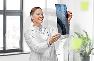 female doctor with x-ray of spine at hospital