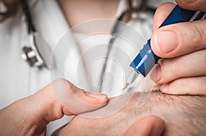 Doctor removing a tick with tweezers from hand of patient