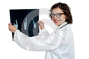 Female doctor reviewing x-ray sheet of a patient