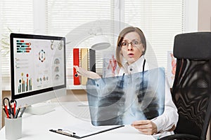 Female doctor sitting at desk, working on computer, holding X-ray of lungs, fluorography, roentgen in light office in