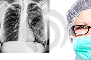 Female doctor in surgical mask and cap with X-ray picture