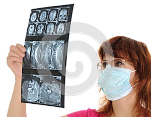 Female doctor with tomogram photo