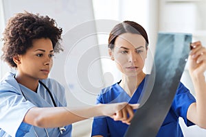 Female doctors with x-ray image at hospital