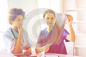 Female doctors with x-ray image at hospital