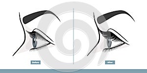 Female Eye Before and After Eyelash Extension. Comparison of Natural and Volume Eyelashes. Side View. Infographic Vector