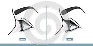 Female Eye Before and After Eyelash Extension. Comparison of Natural and Volume Eyelashes. Side View. Infographic Vector photo