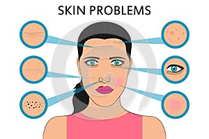 Female face skin problems. Acne and pimples, black spots, redness, dryness, circles under the eyes and wrinkles. Vector. photo