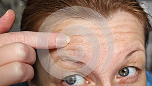 Female forehead with wrinkles and enlarged pores close-up. Skin care in 40 years