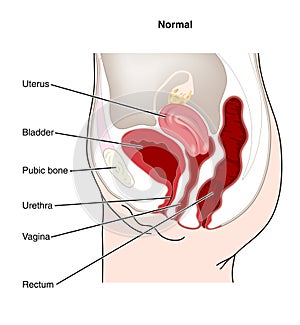 Female genitourinary