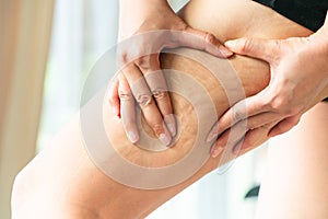 Female hand holds fat cellulite and stretch mark on leg at home, women diet style concept