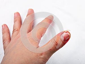 A female hand with nail peeling problem on the white background.
