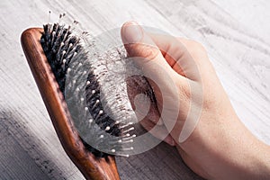 Female Hand Pulling Bunch Of Hair Out Of Brush - Alopecia Hair Loss Concept