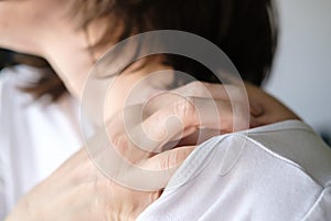 Female hand scratch itchy skin on his shoulder. photo