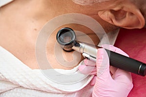 Female hands examine the skin of a man with a dermatoscope