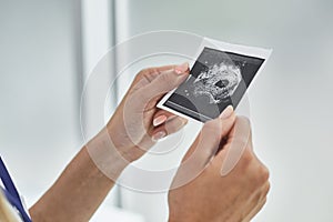 Female hands holding ultrasound picture of baby