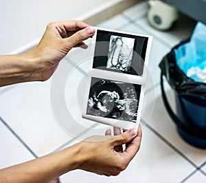 Female hands, showing scan 3D photo of unborn child