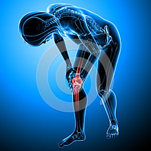 Female knee pain