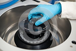 Female lab technician in rubber gloves refills a centrifuge and close the cap.