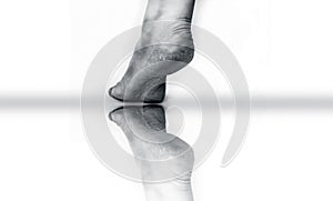 Female leg or heels showing cracked heels isolated on white with its reflection also.