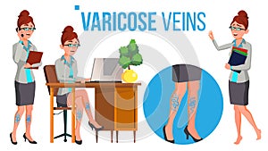 Female Legs In High Heel Shoes With Varicose Veins Vector. Isolated Cartoon Illustration