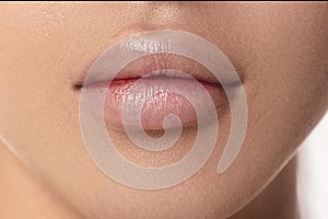 Female lips after augmentation procedure. clean skin.