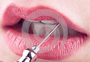 Female lips and medical needle, concept of plastic and aesthetic