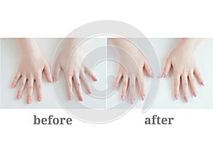 Female manicure. Before and after. Girls hands on white background