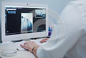 A female medical doctor looking at x-rays and using laptop in a hospital