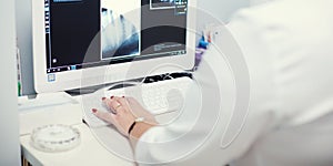 A female medical doctor looking at x-rays and using laptop in a hospital