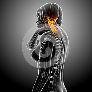 Female neck pain