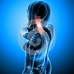 Female neck pain