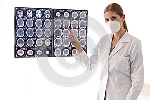 Female neurologist specialist professional doctor with mask reviewing brain scans