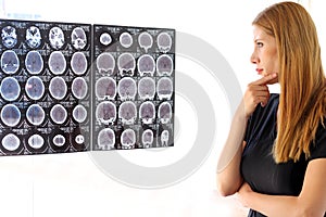 Female neurologist specialist professional doctor with mask reviewing brain scans