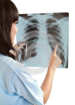 Female nurse pointing at x-ray