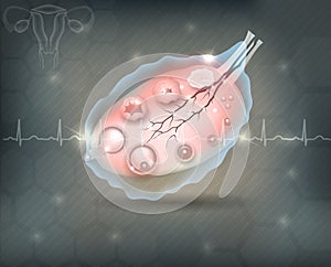 Female ovary photo