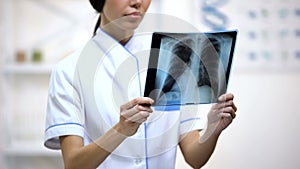 Female physician attentively looking at lungs x-ray, risk of bronchitis, health