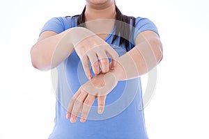 Female scratching her hand on isolated white background. Medical, healthcare for advertising concept