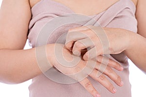 Female scratching her hand isolated white background. Medical, healthcare for advertising concept photo